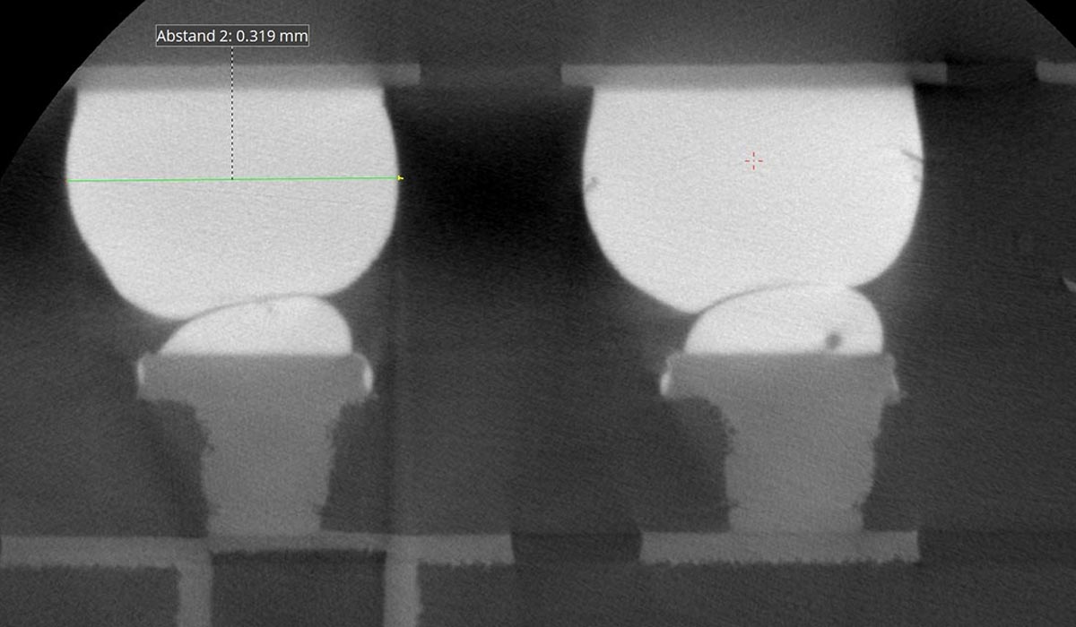 Solder joint inspection in electronics production using 2D X-ray inspection and 3D computed tomography